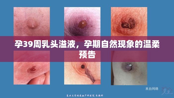 孕晚期乳頭溢液，孕期自然變化的溫馨信號