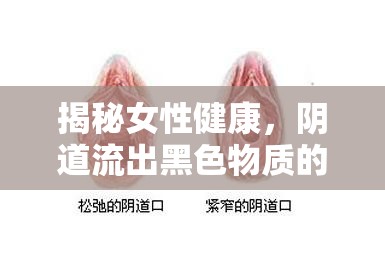 揭秘女性健康，陰道流出黑色物質(zhì)的真相與應(yīng)對策略