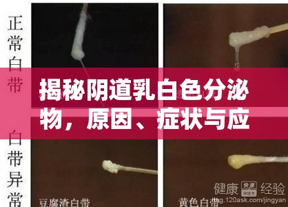 陰道乳白色分泌物，成因、識別與處理指南