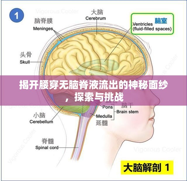 揭開腰穿無腦脊液流出的神秘面紗，探索與挑戰(zhàn)