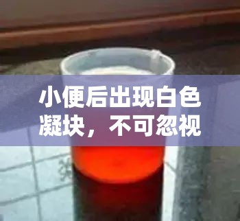 尿液異常，白色凝塊背后的健康警示