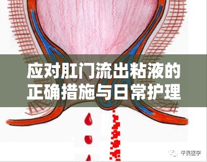 應(yīng)對(duì)肛門流出粘液的正確措施與日常護(hù)理指南