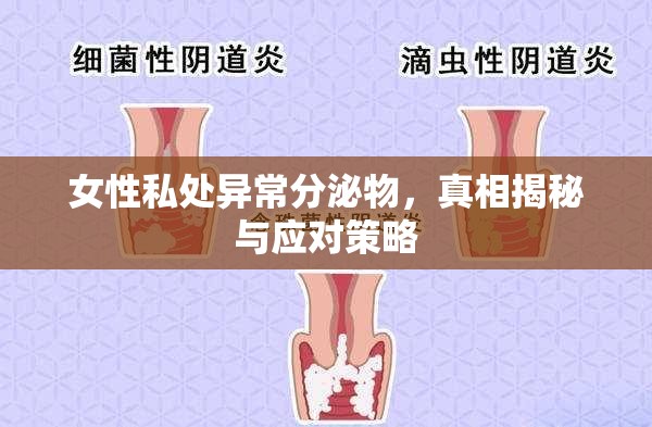 女性私處異常分泌物，原因、識別與處理指南