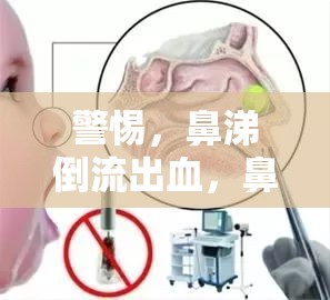 鼻腔健康危機，鼻涕倒流出血的警示信號