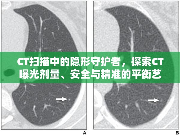 CT掃描中的隱形守護者，探索CT曝光劑量、安全與精準的平衡藝術