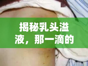 揭秘乳頭溢液，那一滴的背后真相