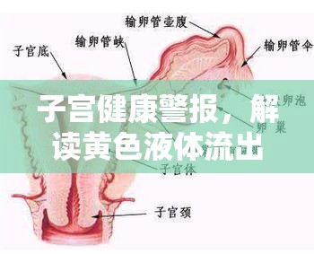 子宮健康警報，解讀黃色液體流出的背后真相