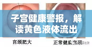 子宮健康警報，解讀黃色液體流出的背后真相