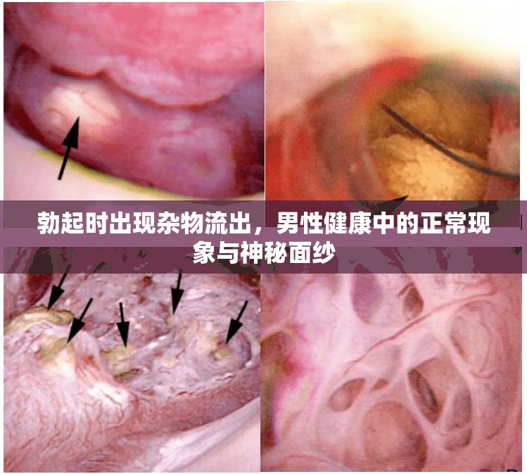 勃起時(shí)出現(xiàn)雜物流出，男性健康中的正?，F(xiàn)象與神秘面紗