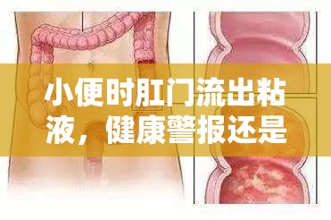 小便時肛門流出粘液，健康警報還是日?，F(xiàn)象？