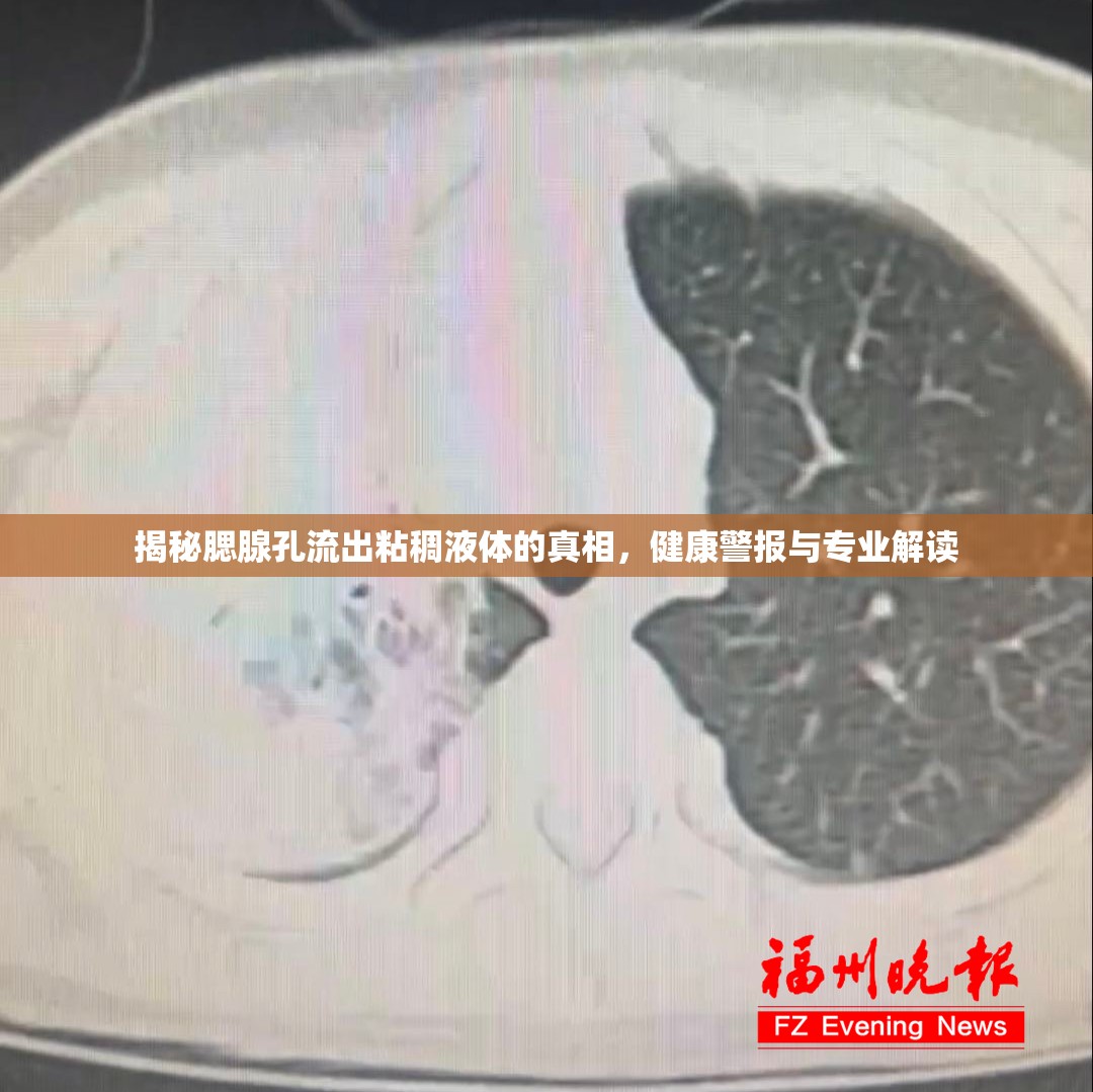 揭秘腮腺孔流出粘稠液體的真相，健康警報與專業(yè)解讀