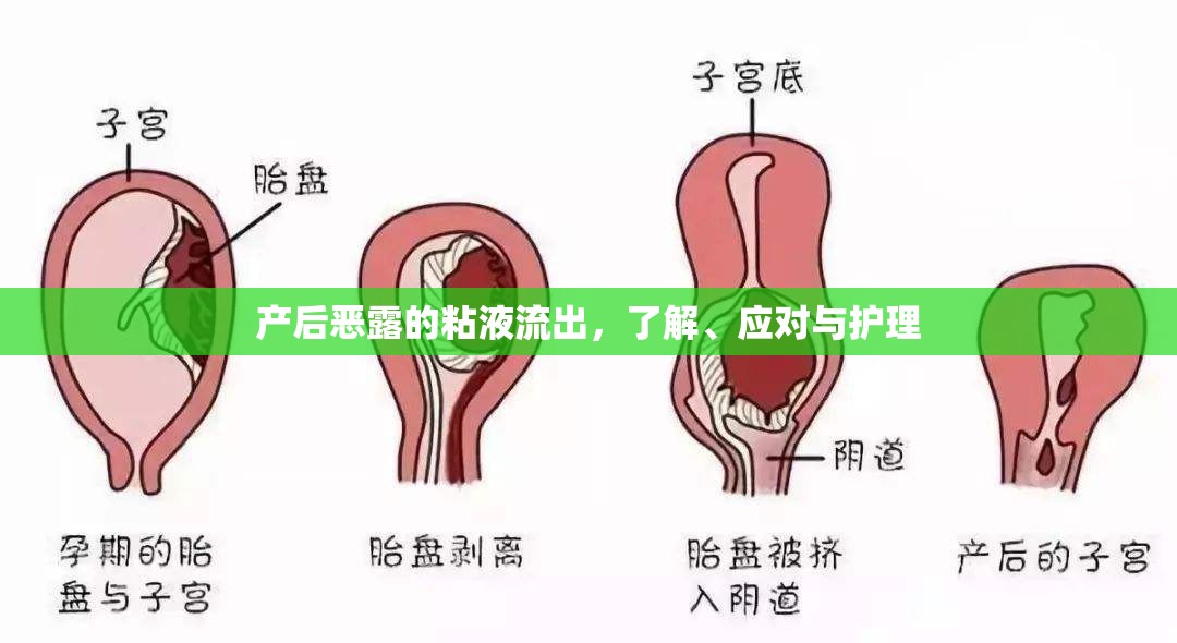 產(chǎn)后惡露的粘液流出，了解、應(yīng)對與護(hù)理