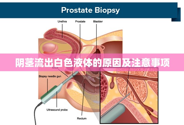 陰莖流出白色液體的原因及注意事項