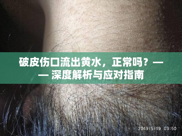 破皮傷口流出黃水，正常嗎？—— 深度解析與應(yīng)對指南