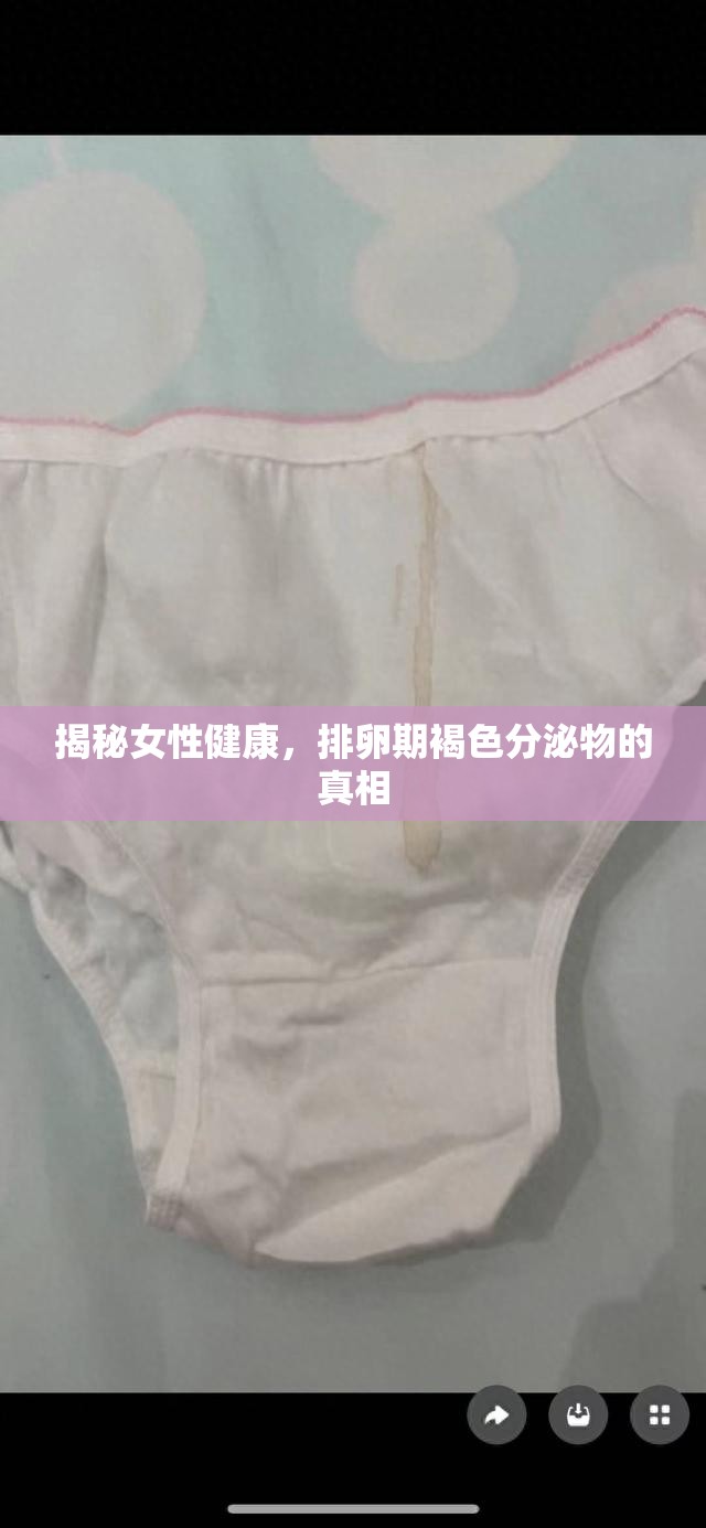 揭秘女性健康，排卵期褐色分泌物的真相