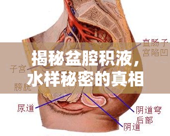 揭秘盆腔積液，水樣秘密的真相