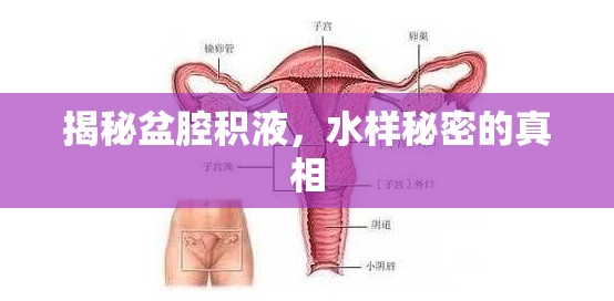 揭秘盆腔積液，水樣秘密的真相