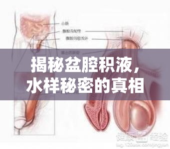 揭秘盆腔積液，水樣秘密的真相