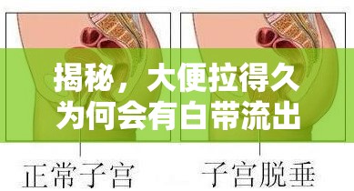 揭秘，大便拉得久為何會(huì)有白帶流出？