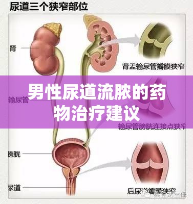 男性尿道流膿的藥物治療建議