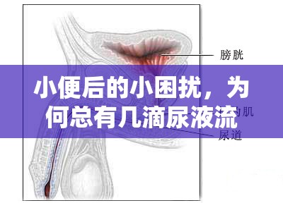 小便后的小困擾，為何總有幾滴尿液流出來？