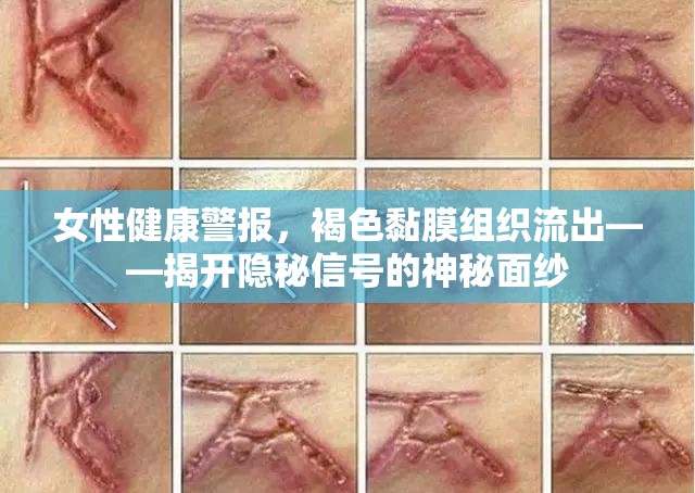 女性健康警報(bào)，褐色黏膜組織流出——揭開隱秘信號(hào)的神秘面紗