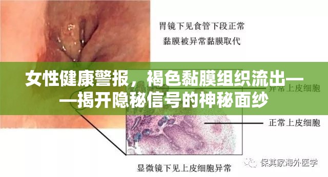 女性健康警報(bào)，褐色黏膜組織流出——揭開隱秘信號的神秘面紗