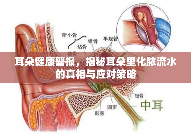 耳朵健康警報(bào)，揭秘耳朵里化膿流水的真相與應(yīng)對(duì)策略