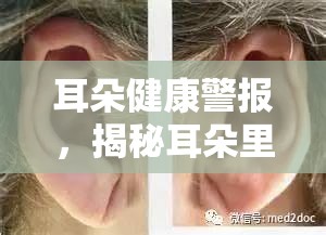 耳朵健康警報，揭秘耳朵里化膿流水的真相與應對策略