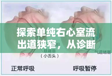 探索單純右心室流出道狹窄，從診斷到治療的新視角