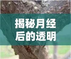 揭秘月經(jīng)后的透明液體，那幾天的生理現(xiàn)象與解讀