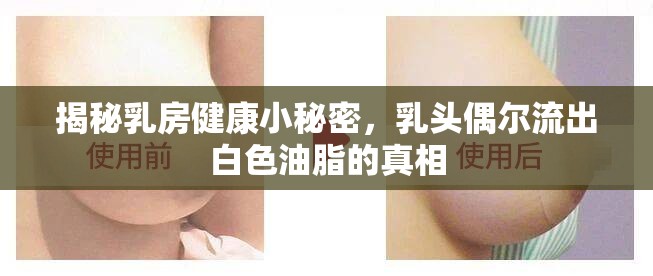 揭秘乳房健康小秘密，乳頭偶爾流出白色油脂的真相