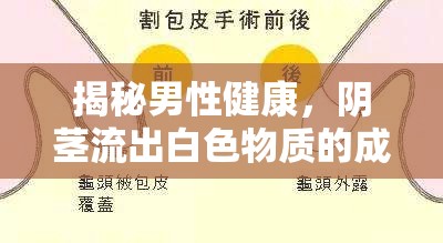 揭秘男性健康，陰莖流出白色物質(zhì)的成因與應(yīng)對(duì)策略