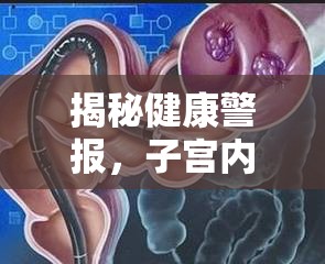 揭秘健康警報，子宮內(nèi)肉瘤的真相與應(yīng)對策略