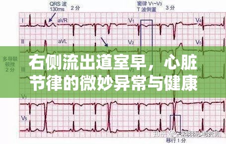 右側(cè)流出道室早，心臟節(jié)律的微妙異常與健康警示