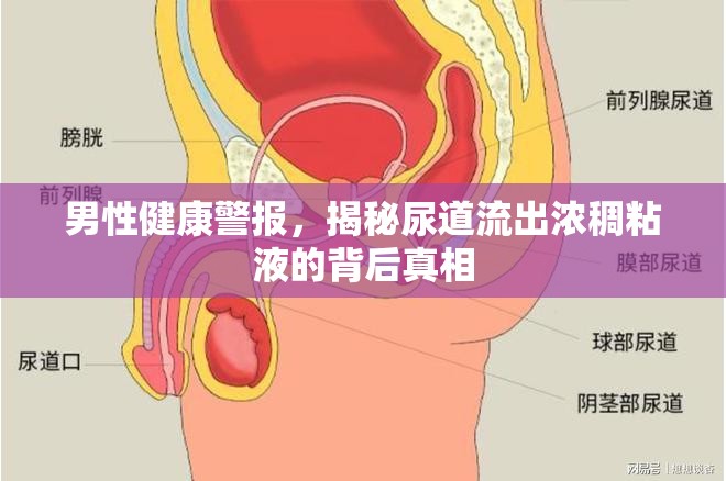 男性健康警報(bào)，揭秘尿道流出濃稠粘液的背后真相