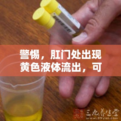 警惕，肛門處出現(xiàn)黃色液體流出，可能是健康警報