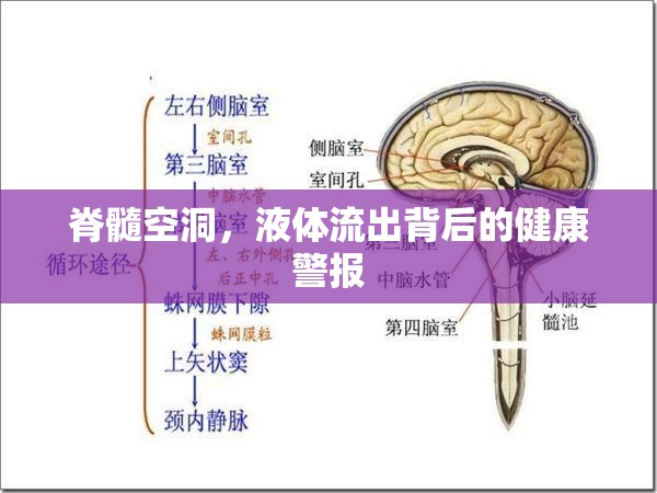 脊髓空洞，液體流出背后的健康警報(bào)