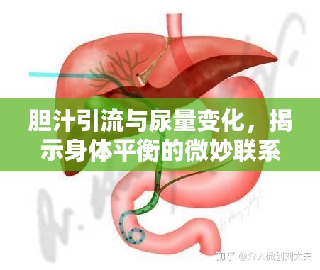 膽汁引流與尿量變化，揭示身體平衡的微妙聯(lián)系