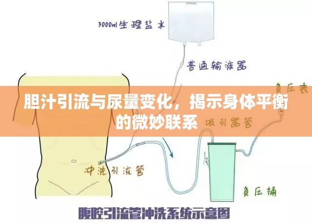 膽汁引流與尿量變化，揭示身體平衡的微妙聯(lián)系