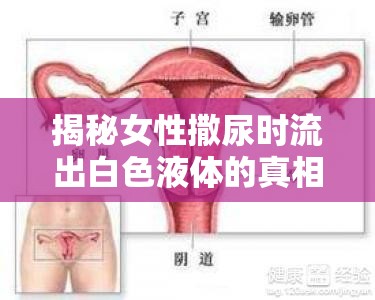 揭秘女性撒尿時流出白色液體的真相