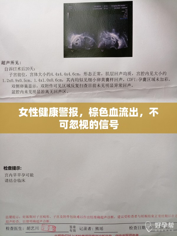 女性健康警報，棕色血流出，不可忽視的信號