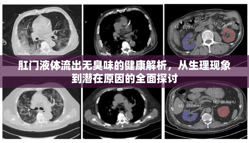 肛門液體流出無臭味的健康解析，從生理現(xiàn)象到潛在原因的全面探討