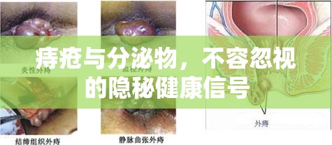 痔瘡與分泌物，不容忽視的隱秘健康信號