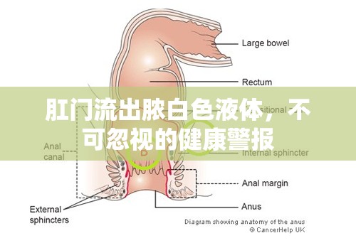 肛門流出膿白色液體，不可忽視的健康警報(bào)