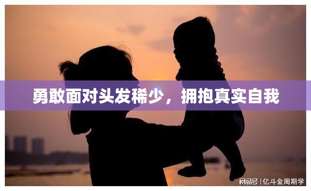 勇敢面對頭發(fā)稀少，擁抱真實自我