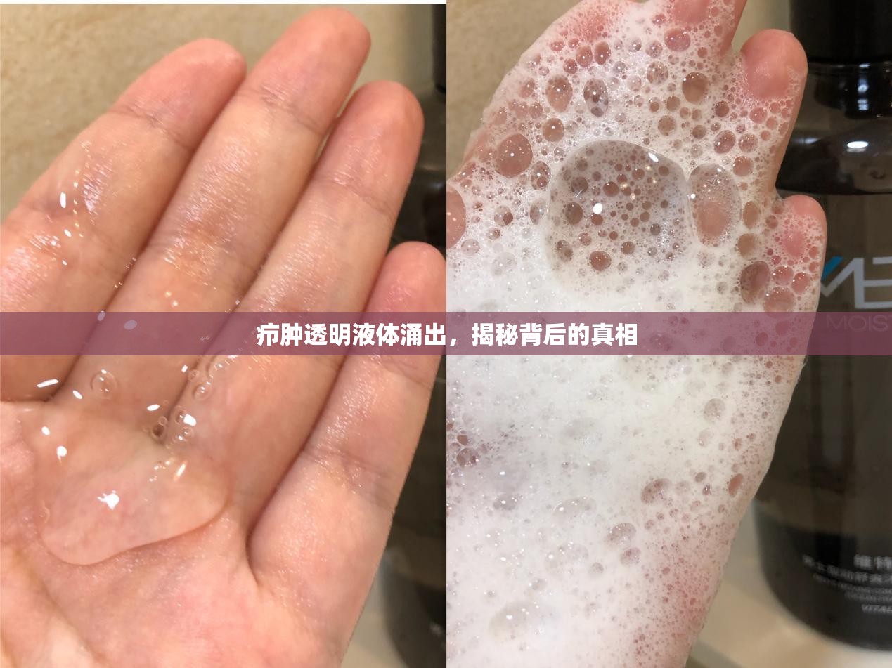 癤腫透明液體涌出，揭秘背后的真相