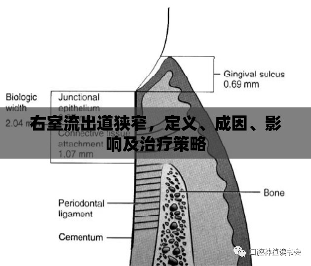 右室流出道狹窄，定義、成因、影響及治療策略