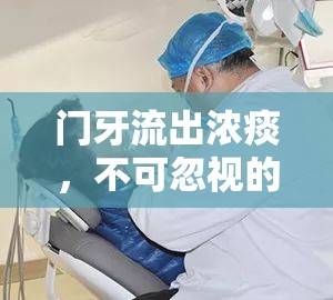 門牙流出濃痰，不可忽視的口腔健康警報