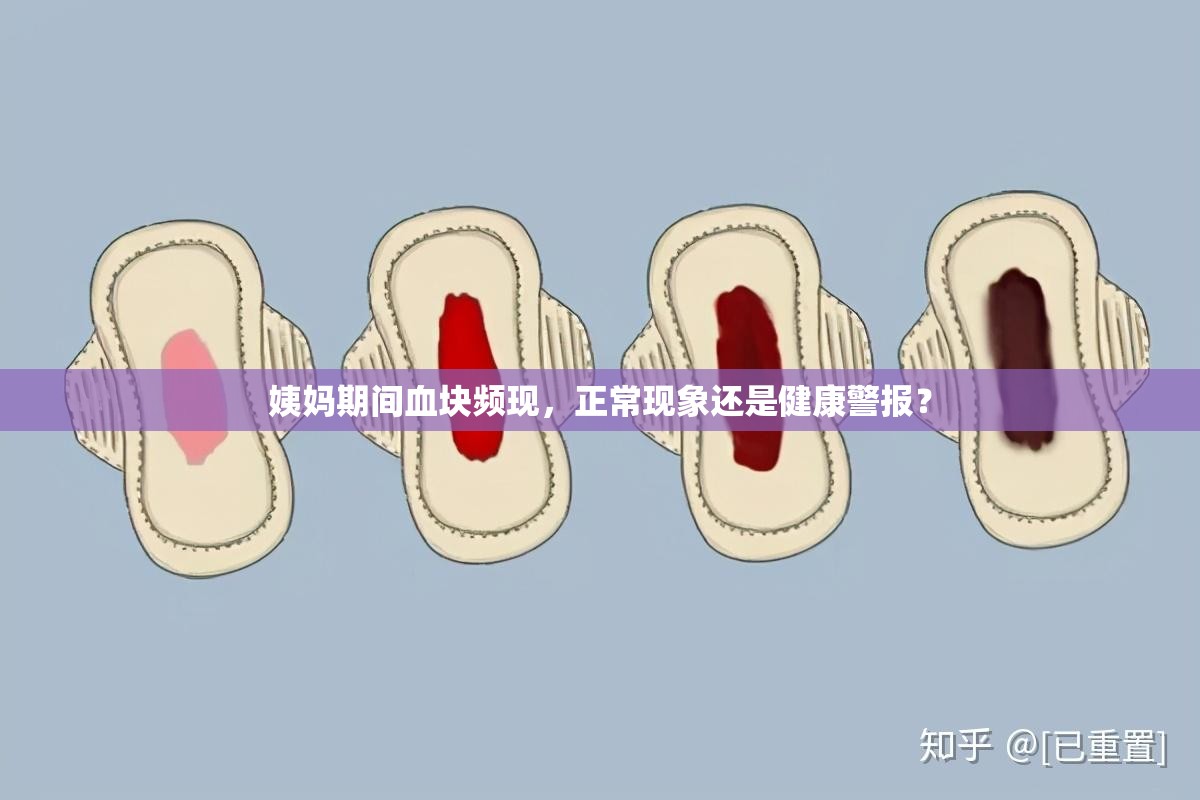 姨媽期間血塊頻現(xiàn)，正?，F(xiàn)象還是健康警報(bào)？